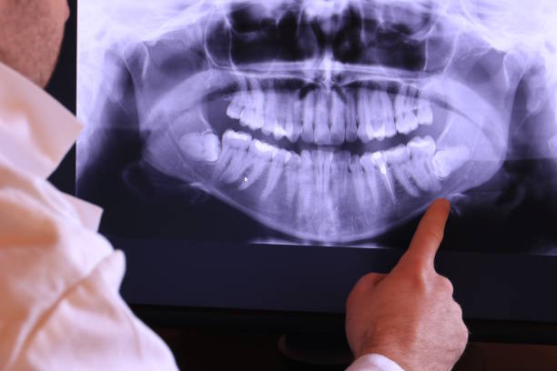 Best Mobile Emergency Dentist in South Oroville, CA