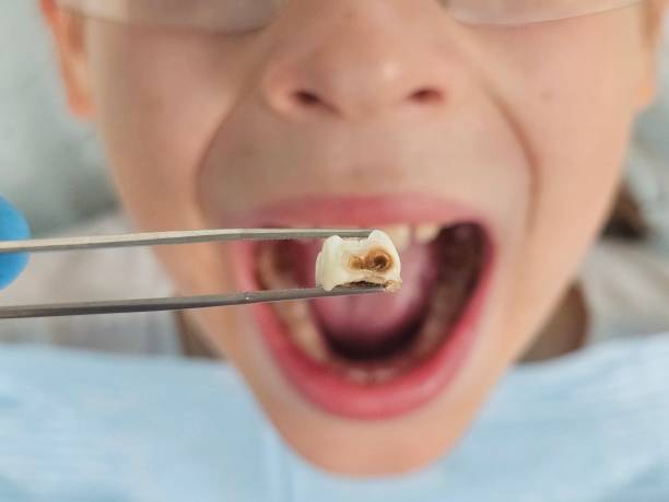 Best Emergency Dental Services for Seniors in South Oroville, CA